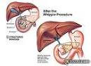 CAMBIOS FISIOLÓGICOS DEL ORGANISMO EN FUNCIÓN DE LA INTENSIDAD Parte II PANCREAS - CAMBIOS FISIOLÓGICOS DEL ORGANISMO EN FUNCIÓN DE LA INTENSIDAD Parte II