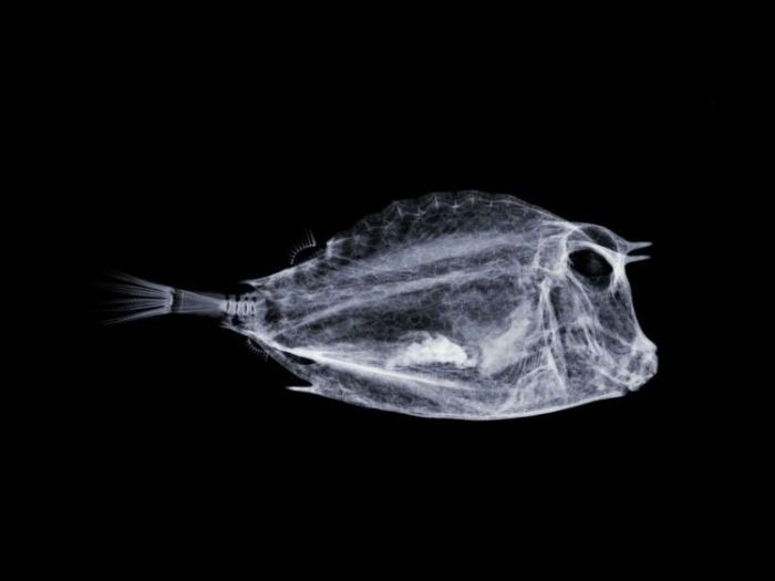 Xray photoshop ~ Alpin Funny Picture!!