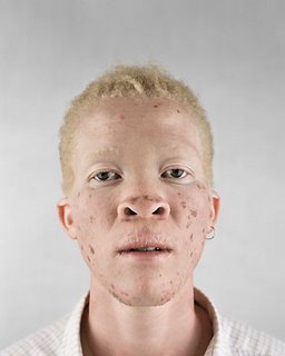 [albino12.jpg]