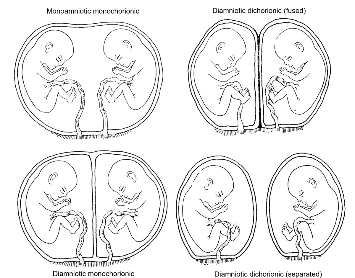 Double Babies You can never have too many placentas