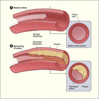 Blood+cholesterol+levels