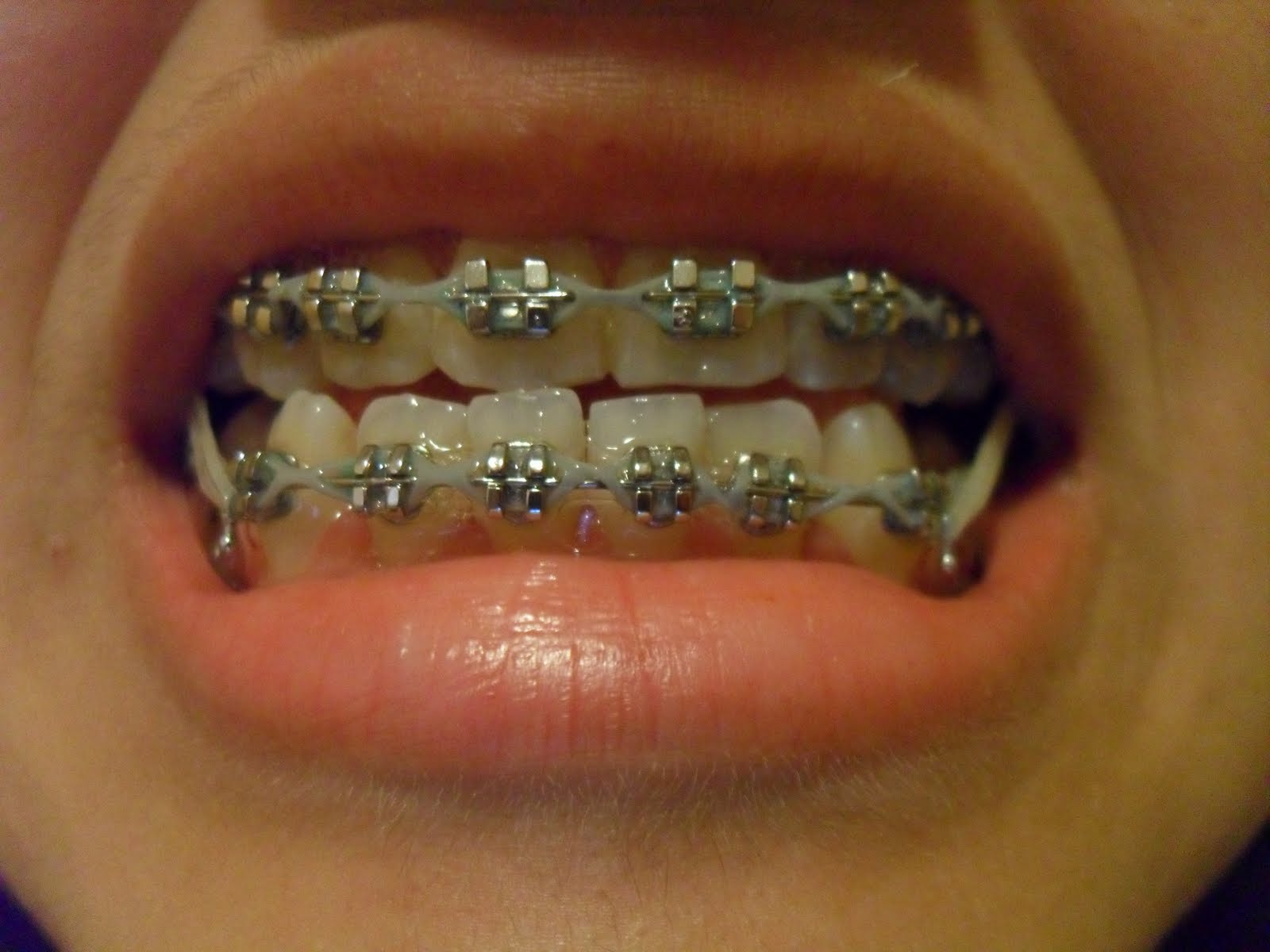 My Metal Madness Catching up on my "Metal Madness"