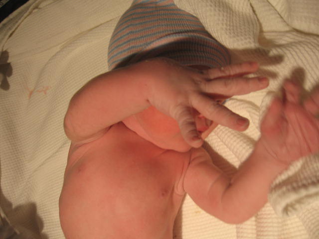 Giant Hands