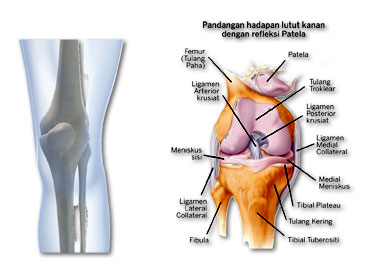 acl+2.jpg
