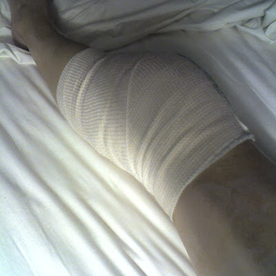 Bandaged knee