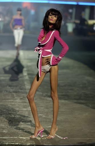 [Anorexia.jpg]