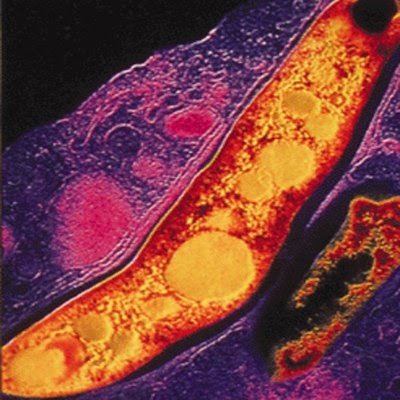 DIAGNOSTICO DE MYCOBACTERIUM TUBERCULOSIS diagnostico de mycobacterium tuberculosis: