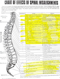 chiropractor on the move chart of effects of spinal spinal misalignment chart