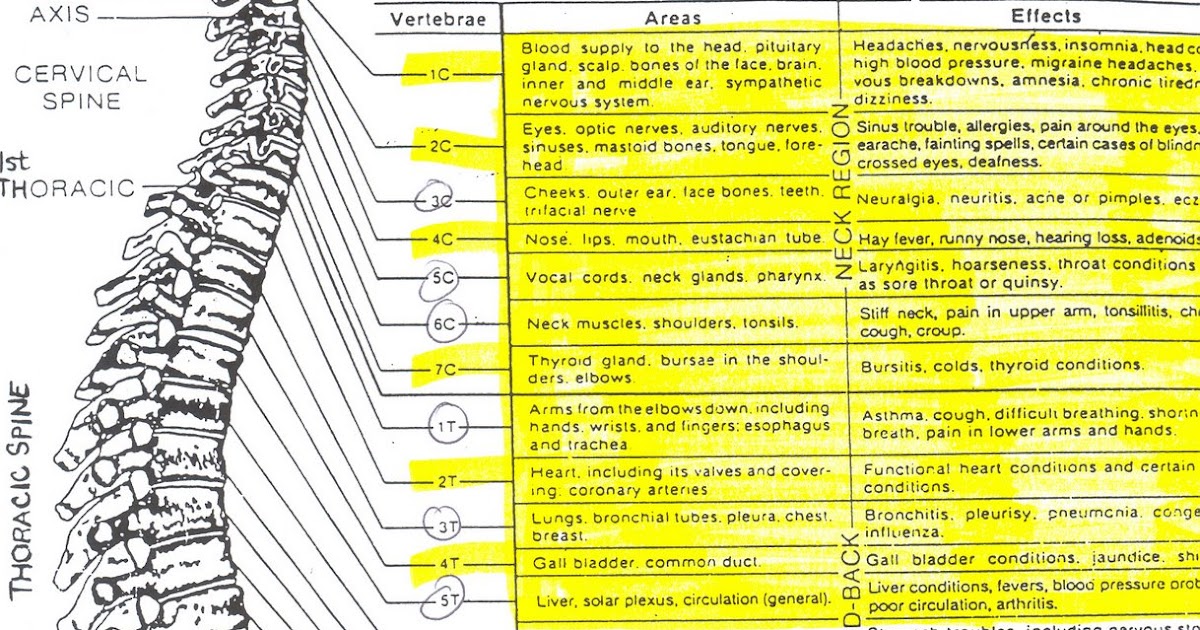 Chiropractor On the Move CHART OF EFFECTS OF SPINAL MISALIGNMENTS