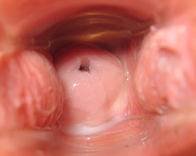 Today On The Interwebs: [NSFW?] Beautiful Cervix Project