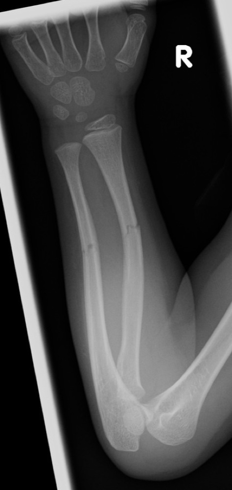 Fractures & Inj...