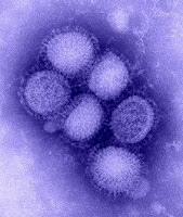 Вирус гриппа A(H1N1) под электронным микроскопом. Реальный диаметр вируса — 80–120 нм