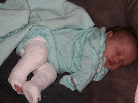 Gracie's first leg casts
