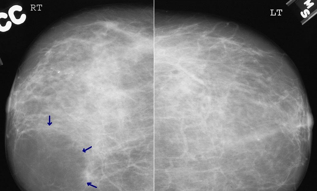 DİŞ TOMOGRAFİSİ SEFALOMETRİK PANORAMİK DİŞ RÖNTGENİ 02165218836