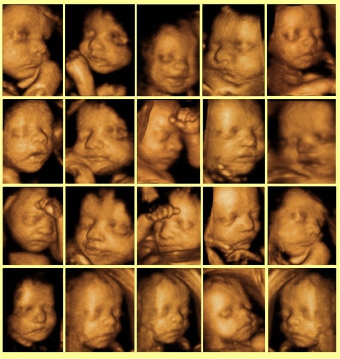 Dis Tomografisi Panoramik Sefalometrik Rontgen Check Up Merkezi 0 216 5218836 Radistanbul 0 216 5218836 Dort Boyutlu Usg Radistanbul Usg