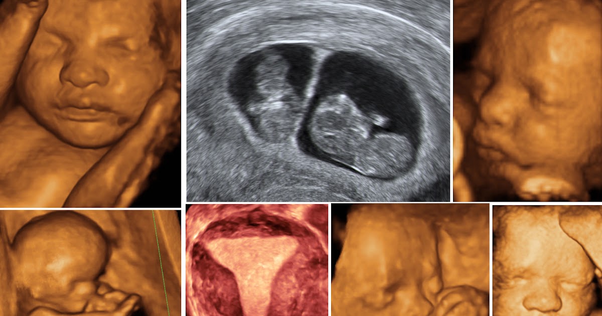 DENTAL VOLUMETRİK DİŞ TOMOGRAFİSİ VE RENKLİ DÖRT BOYUTLU USG 0216