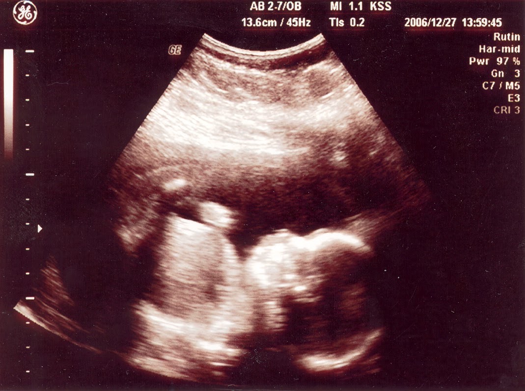 dejting hur gör man ultraljud