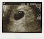 First Ultrasound
