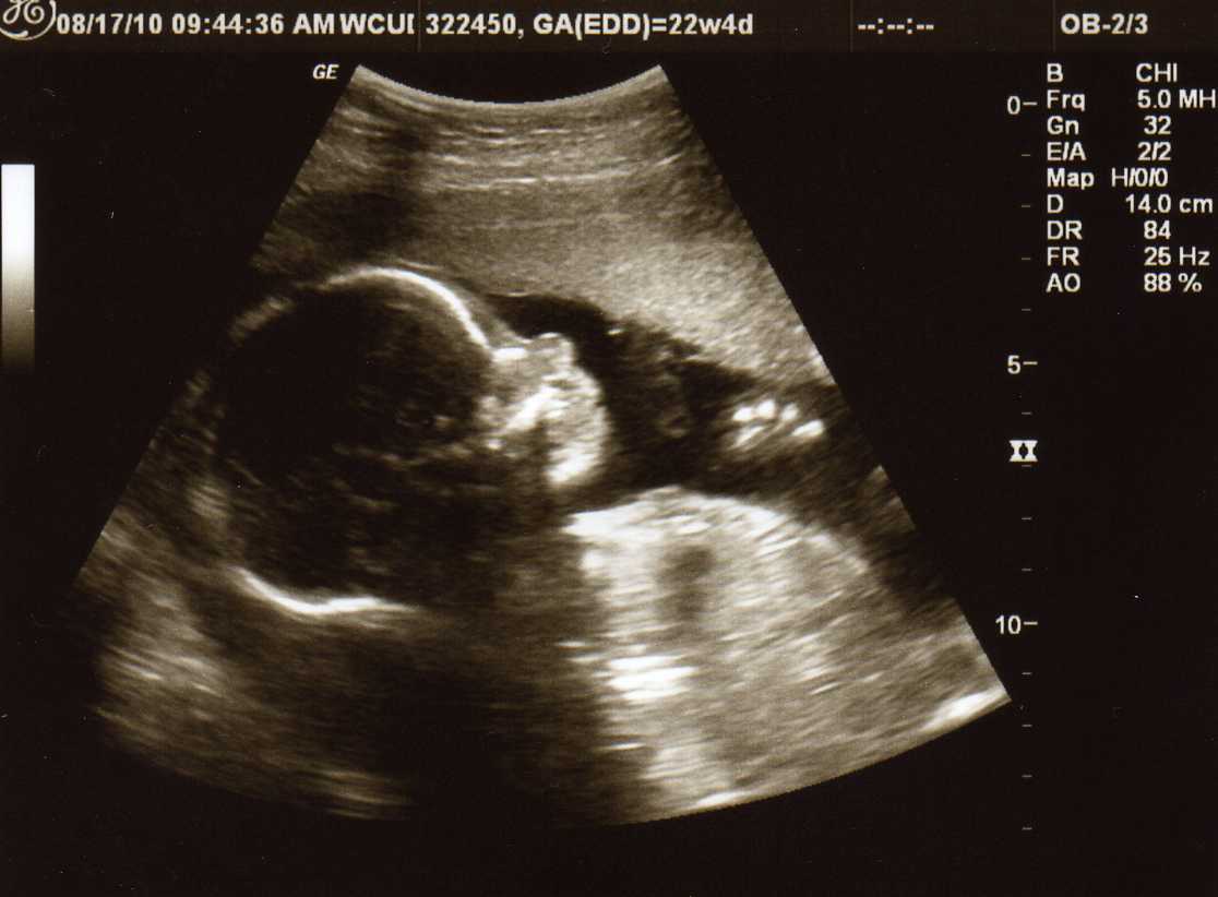 At almost 24 weeks pregnant,