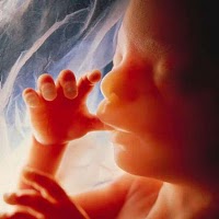 ACTION FOR THE UNBORN