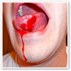 http://2.bp.blogspot.com/_ME1IxzjgQZc/RjGosoIkIUI/AAAAAAAAAN0/eoIh0mrFydk/s320/Tongue+Bite.png