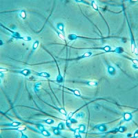 Tip memperbaiki Kualitas Sperma Sperma