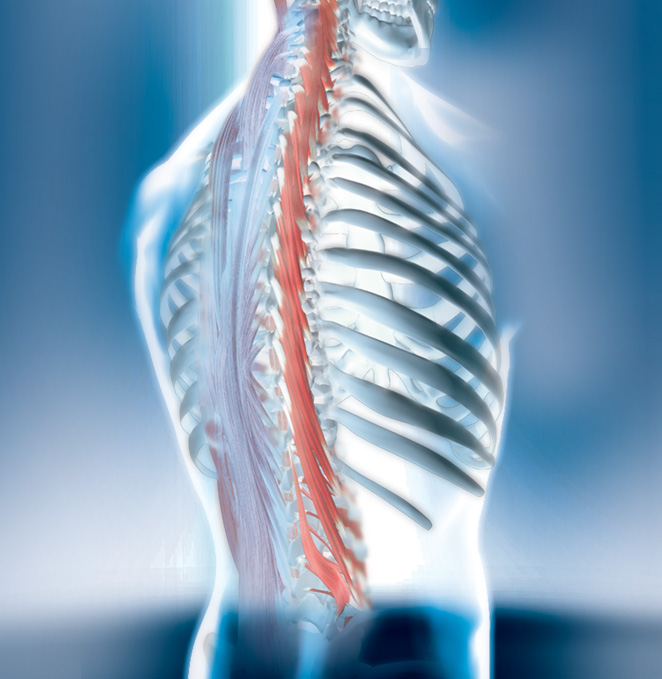 Retrolisthesis c spine picture