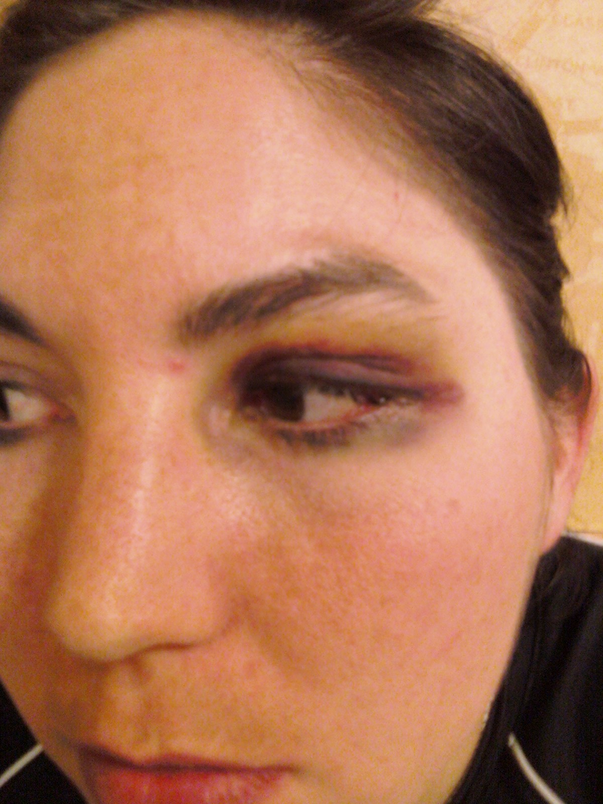 Acrylic and Steel Evolution of a Black Eye.