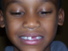 Daddny Tooth Is Missing