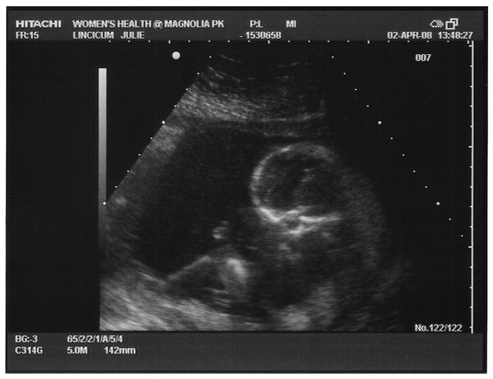 Madelyn Marie Lincicum Arrived August 22, 2008 at 8:46 pm: Madelyn