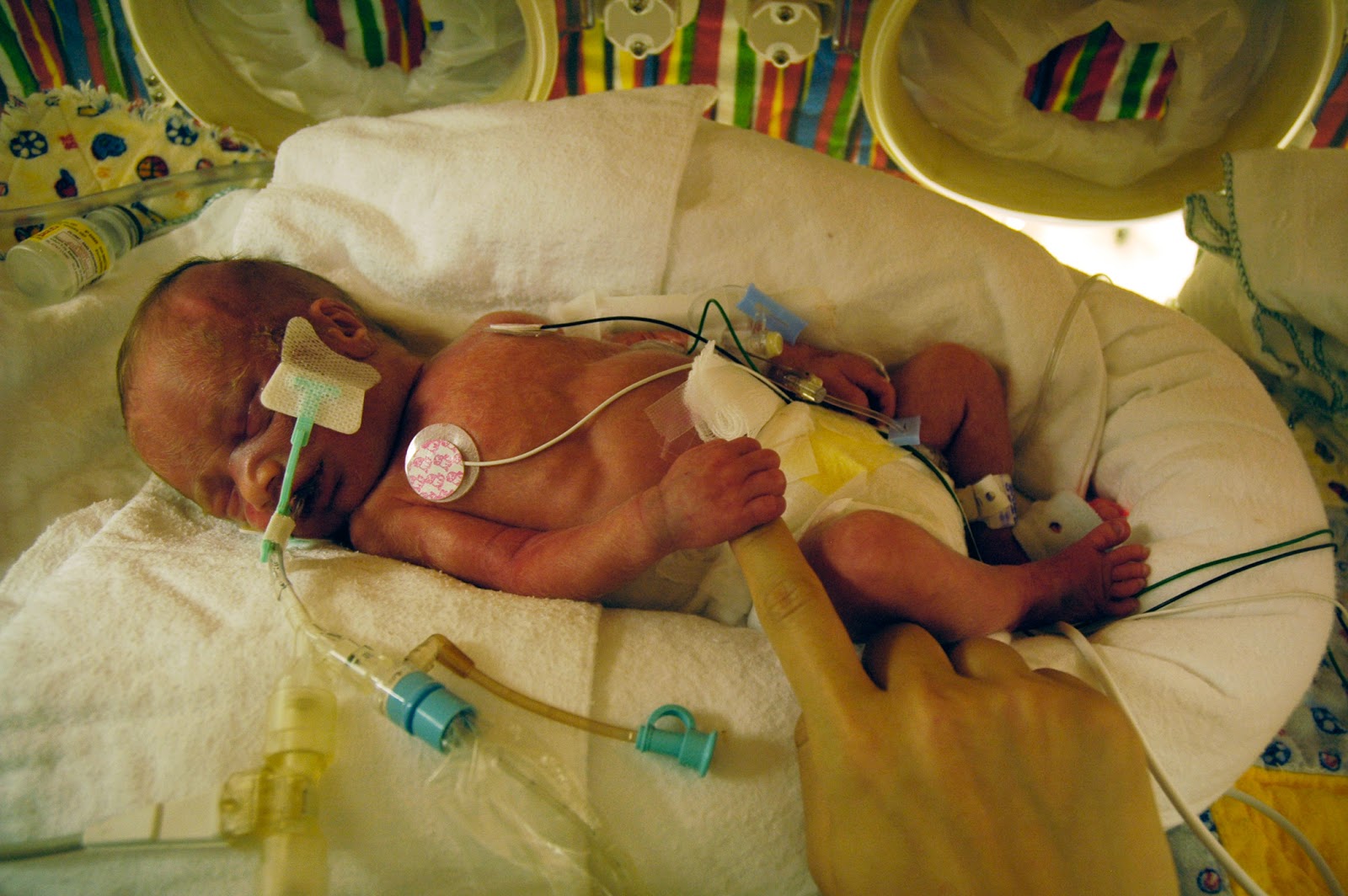 How+big+is+10+centimeters+dilated