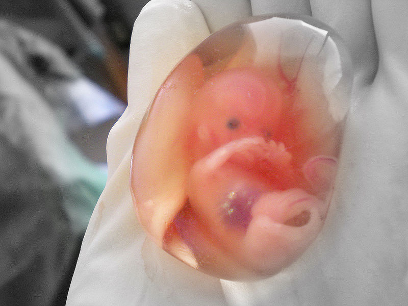 abortion at 8 weeks. more.