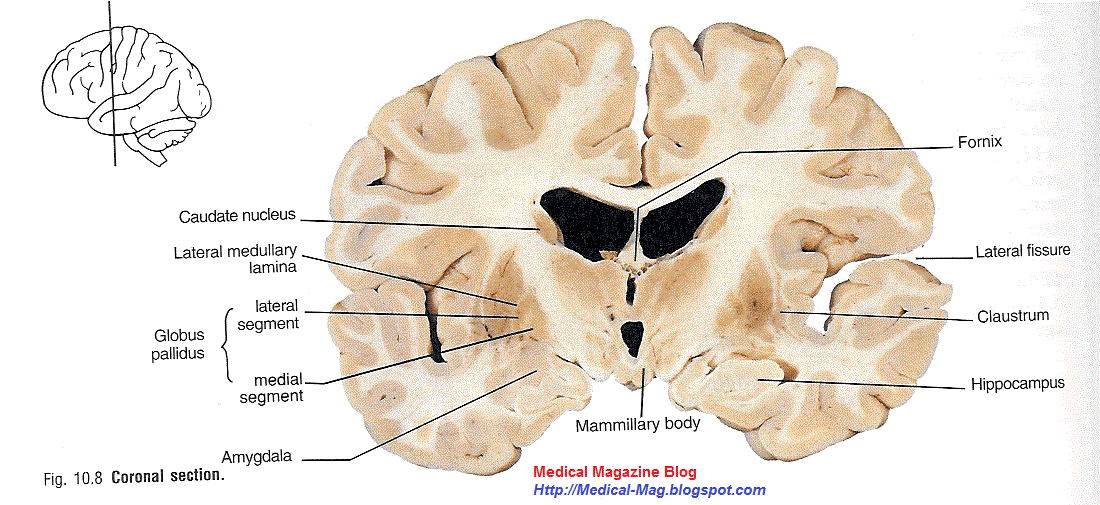 Huntington's disease causesymptoms treatment Medical Mag