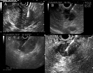 Internal Organs Pancreas