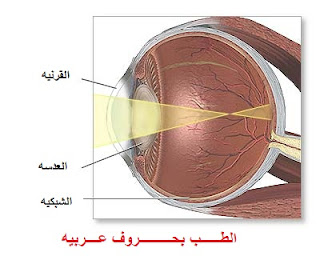 الجلوكوما Glaucoma تقنيات العلاج المختلفه Radial-keratotomy-for-myopia-indications-picture+%25D9%2582%25D8%25B5%25D8%25B1+%25D8%25A7%25D9%2584%25D9%2586%25D8%25B8%25D8%25B1+myopia