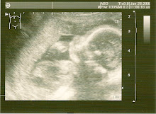 Our precious gift, 21 Weeks