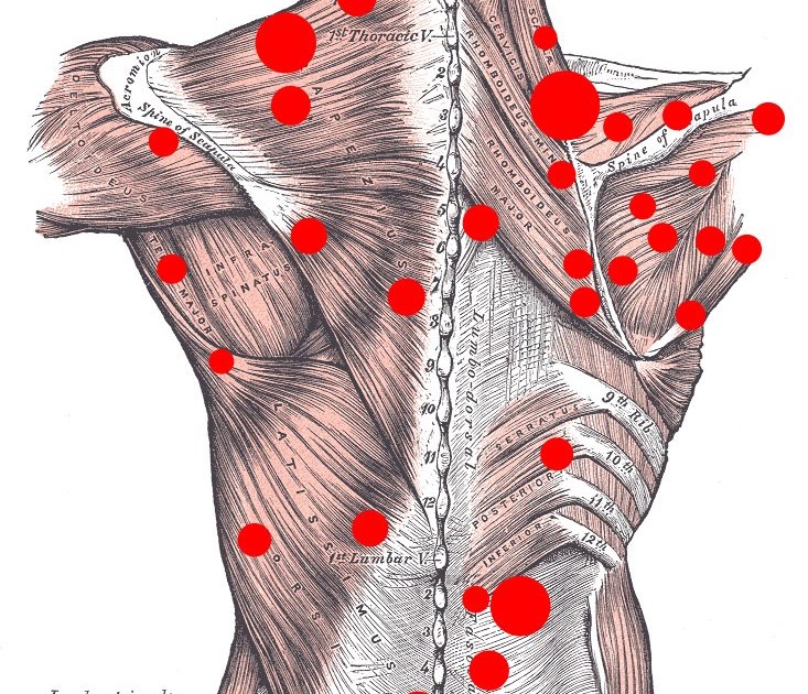 TRAIN OUT PAIN Trigger Points Explained