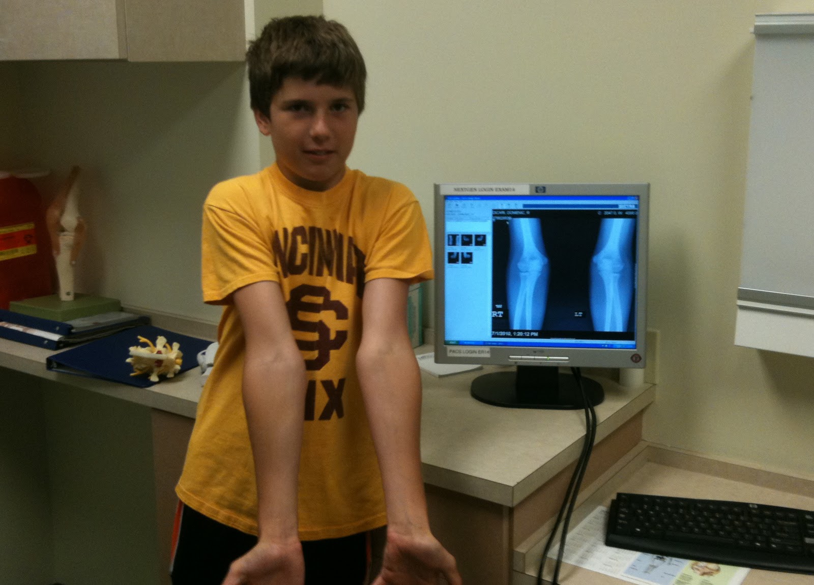 STATS DAD Youth Baseball Elbow Injury