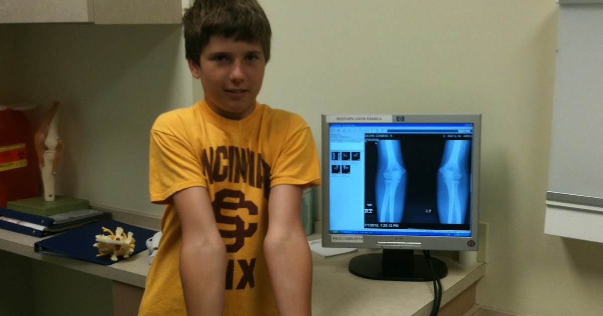 STATS DAD Youth Baseball Elbow Injury