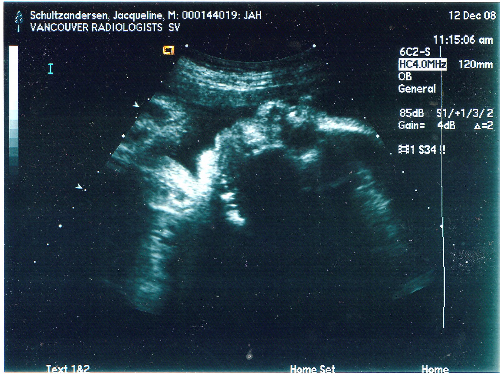 [ultrasound.jpg]