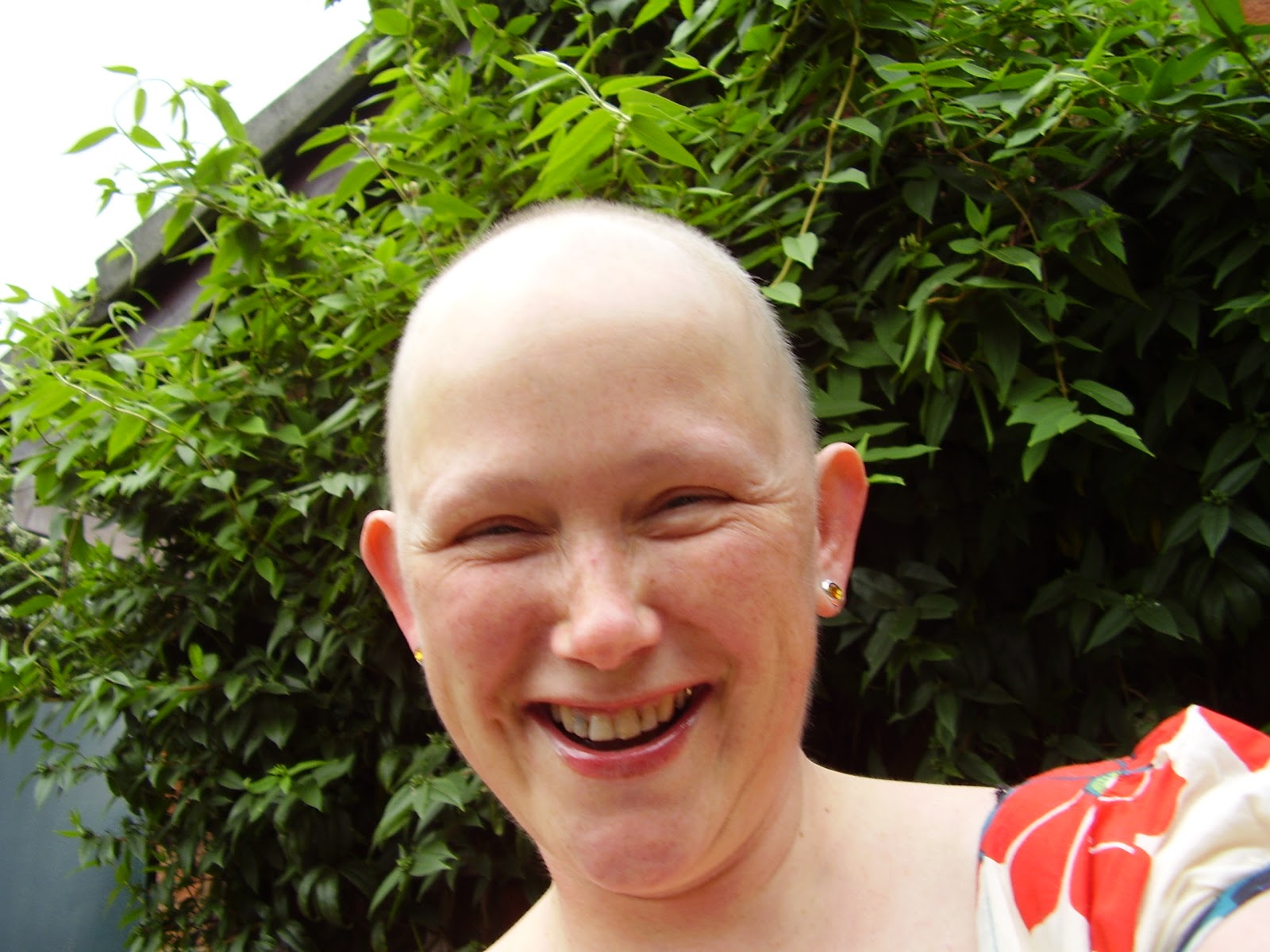 Cancer No Hair