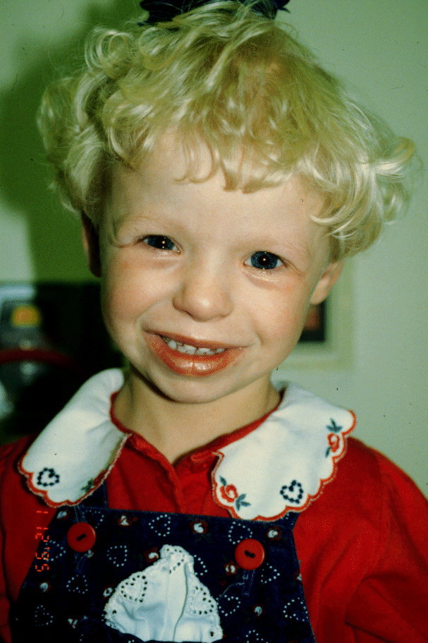 williams syndrome chromosome.