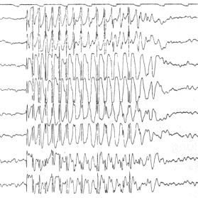 [eeg.jpg]