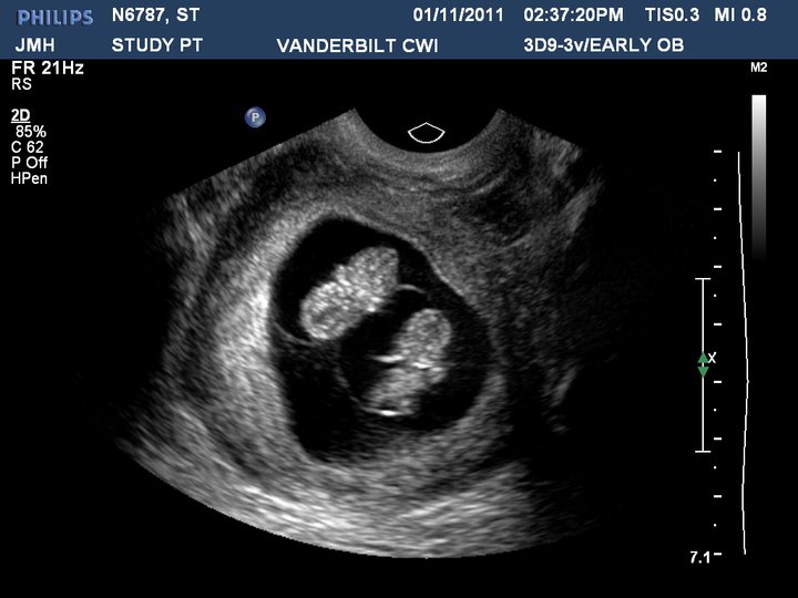 Little Kitchen, Lovely Food. Soft Pretzels