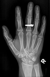 Right Thumb Ring Female Right Thumb Ring Female
