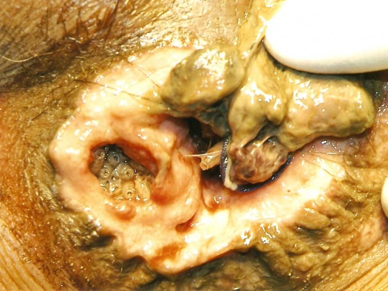 brain tumor surgery and sex ... the vocational trajectory of a wannabe ... brain tumor surgery and sex ... the vocational trajectory of a wannabe ...