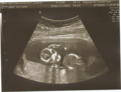 sonogram 5 weeks. Baby Pictures @ 14 Weeks amp; 3
