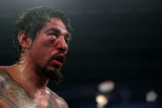 Antonio Margarito Face