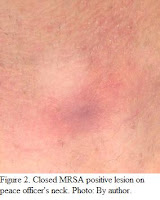 MRSA info for cops and firefighters