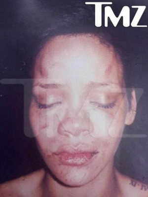 This is a photo of Rihanna after her fight with Chris Brown.